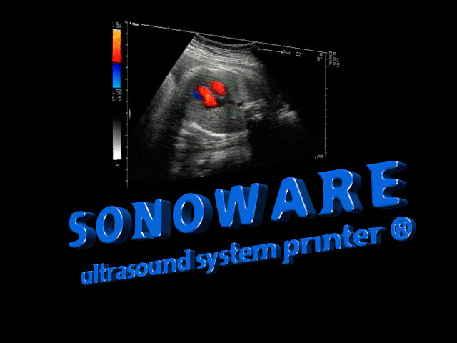 sonoware-old