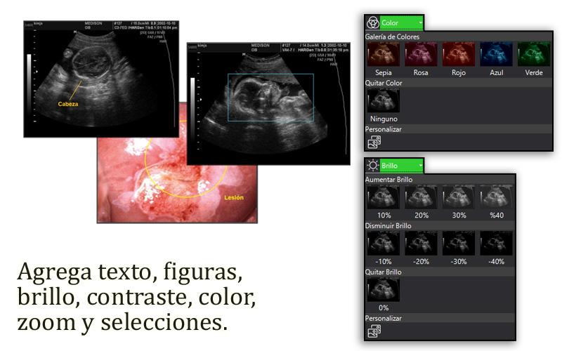 Nuevo scanner de ultrasonidos en Dermomedic - Dermomedic